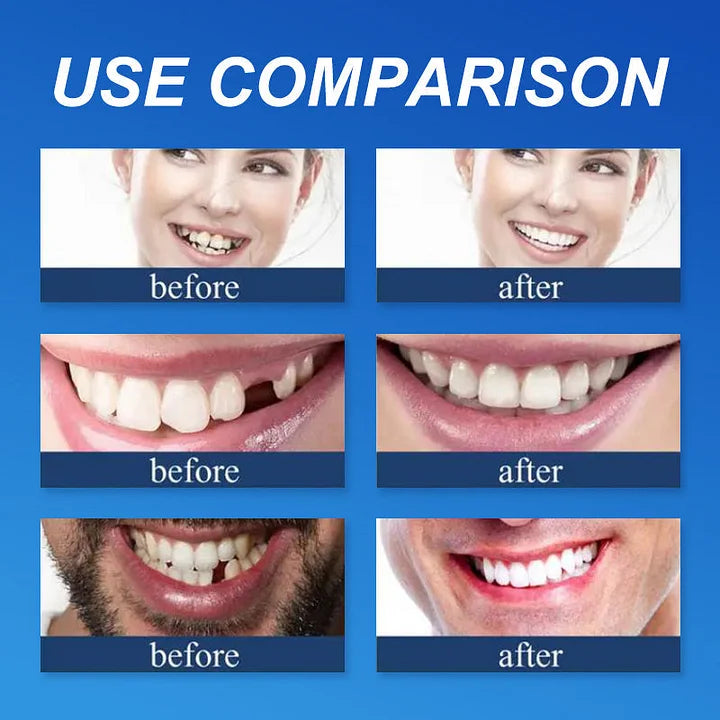 SmileLock – Vollprothese mit starkem Saugsitz