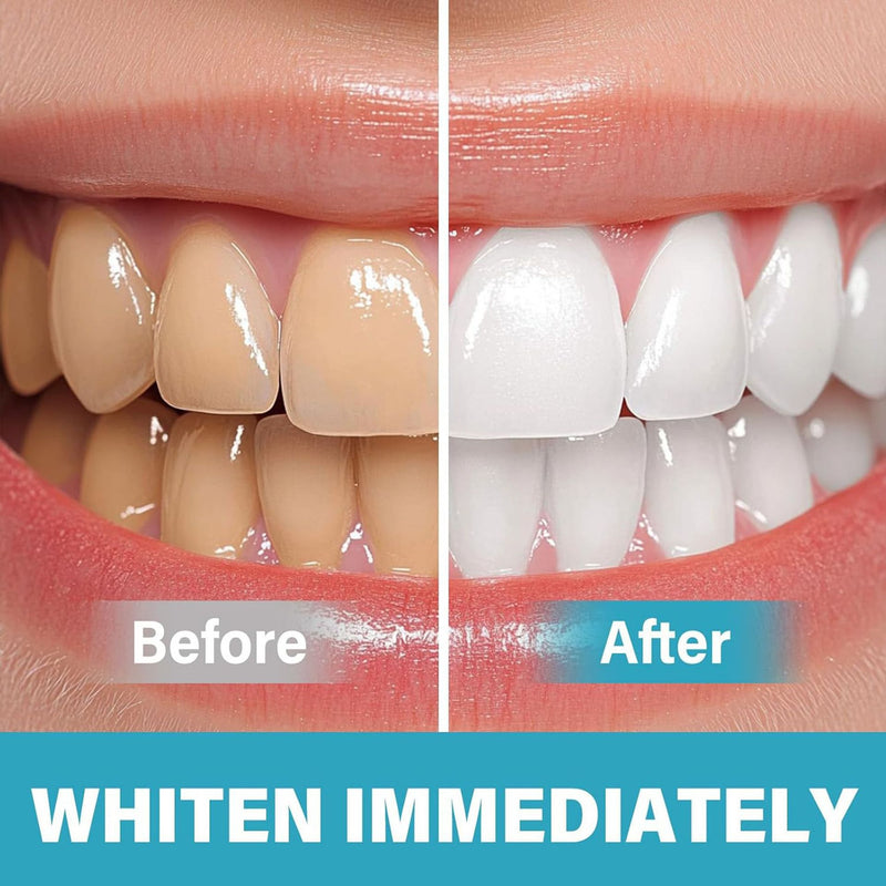 BrightSmile – Sofortige Zahnaufhellung mit Pigment